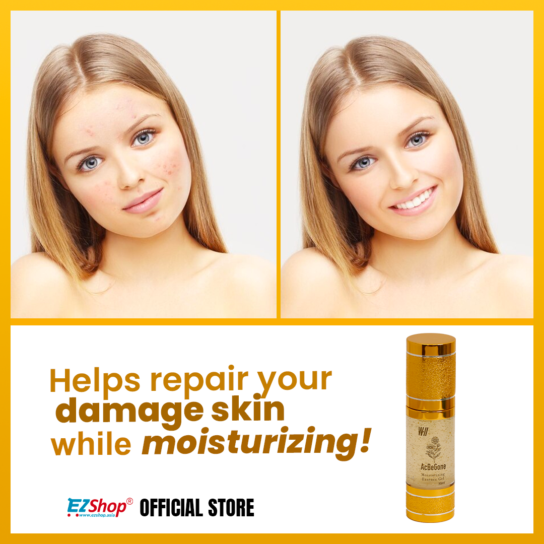 Acbegone Moisturizing Essence Gel